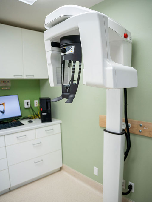 CBCT3